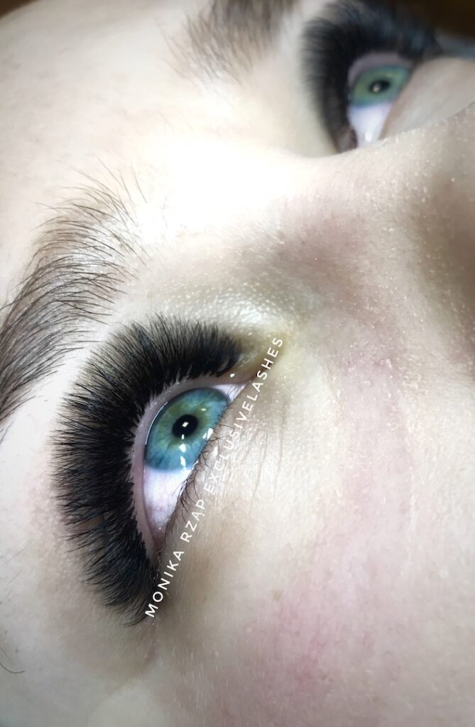 Megavolume 10 - 15D zabieg