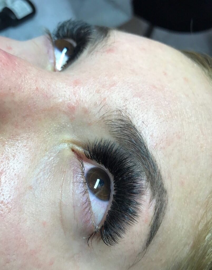 Megavolume 10 - 15D zabieg